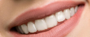 teeth whitening in oxnard