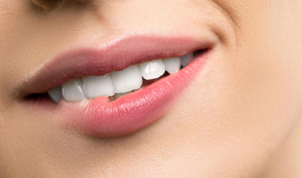 white teeth